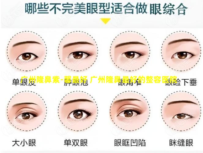 广州隆鼻紫-馨最好 广州隆鼻最好的整容医院
